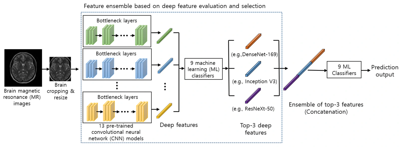 Brain MRI classification pipeline evaluating features from 13 pretrained CNNs, selecting and concatenating the top three, and applying machine-learning classifiers