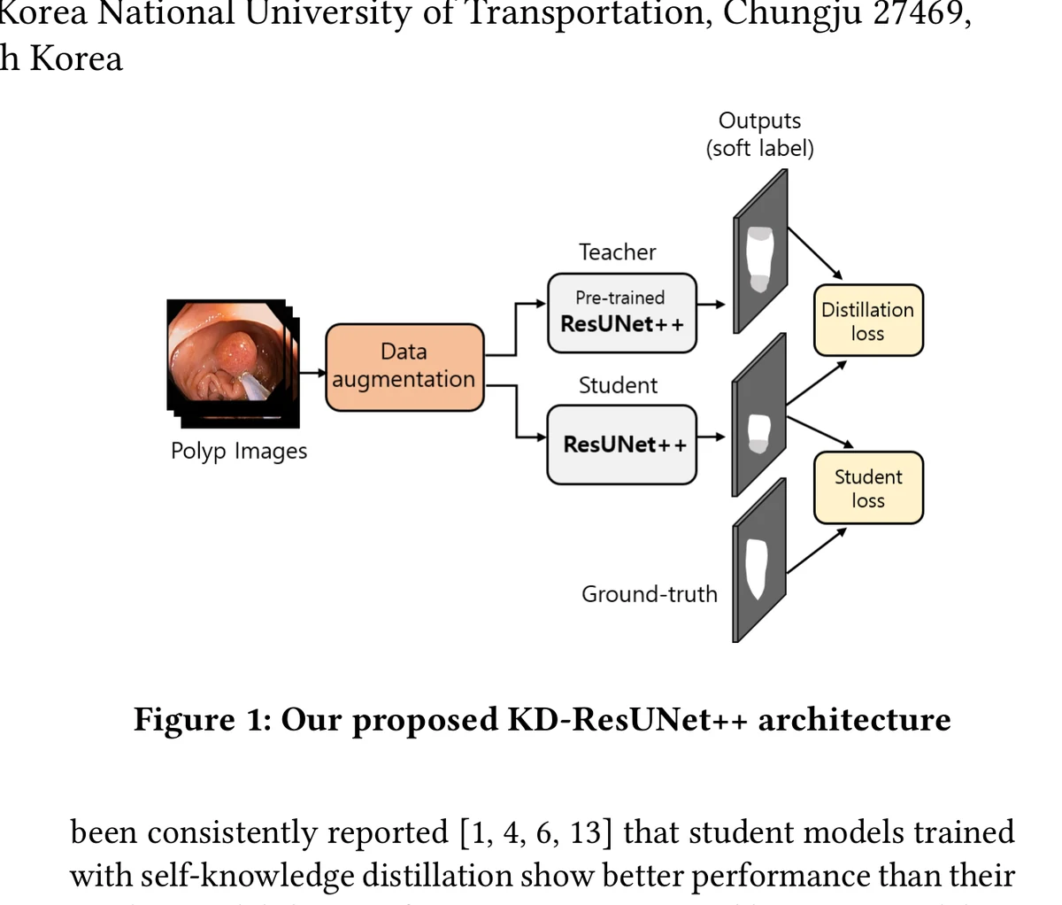 ResUNet++ teacher-student architecture with data augmentation and segmentation outputs